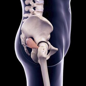 A dor nas costas da adaga pode ser devido ao espasmo do músculo piriforme