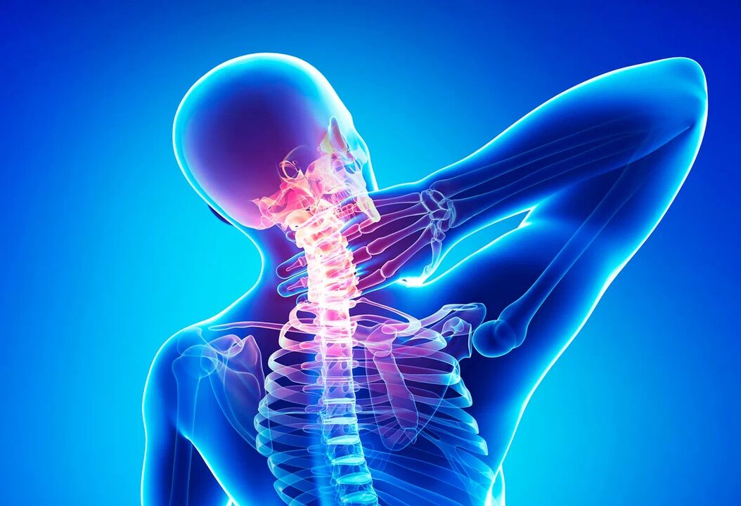 A osteocondrose da coluna vertebral é uma doença comum que requer tratamento. 